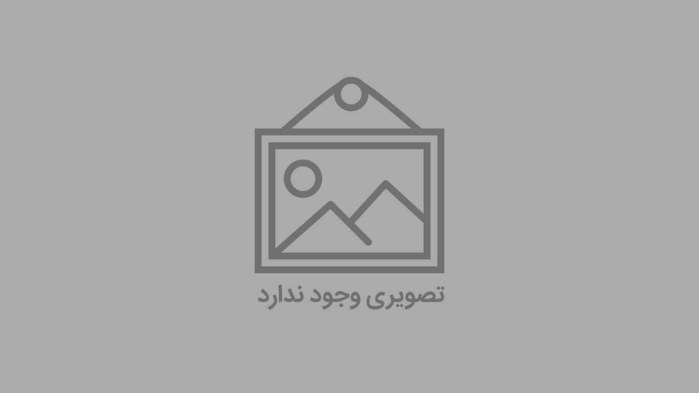 معرفی  روش لیفت صورت در کلینیک بین المللی الهیه تهران