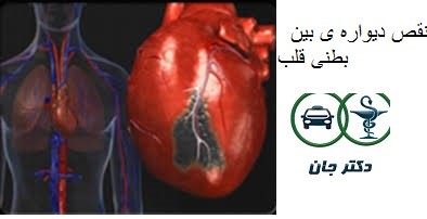 نقص دیواره بین بطنی (VSD)قلب