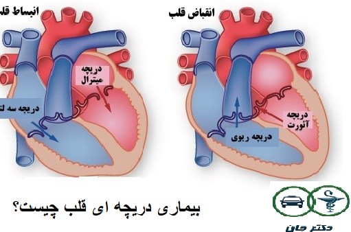 بیماری دریچه ای قلب